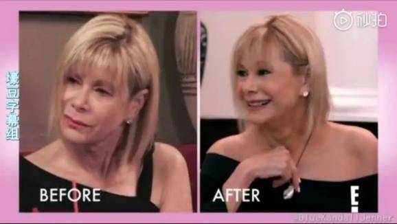 年轻人|年轻人做起医美来，到底有多拼？