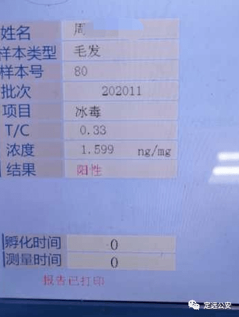 毛发检测多少数值合格 2aa1cd3da36c4fe5930cdf5828b35269.png