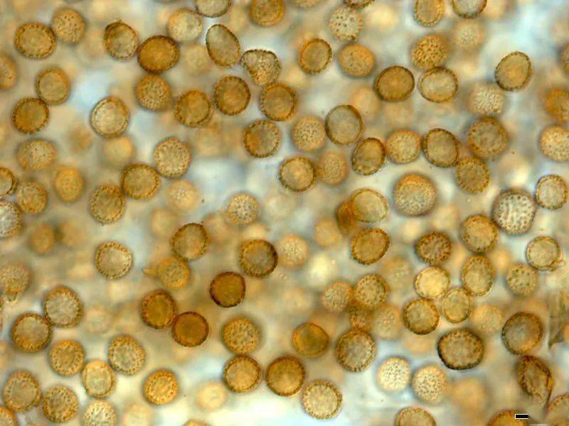 显微镜下的玉米黑粉菌孢子| 图源:collections