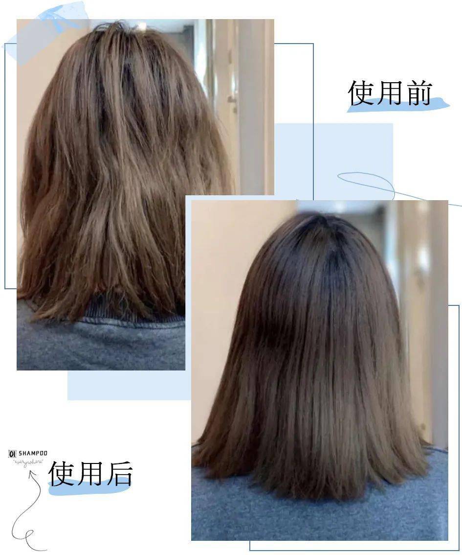 克兰|头上抠下的“白泥”，居然不是头皮屑？脱发头油都是因为它？