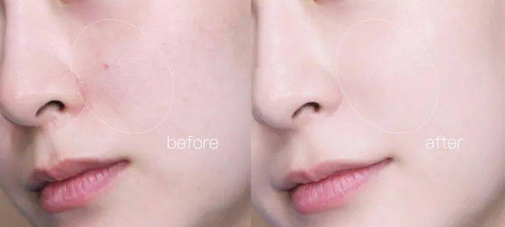 皮肤|毛戈平又放大招，“重返”20岁原来这么简单？