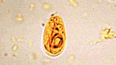 常规的氯消毒无法杀灭隐孢子虫卵囊和贾第鞭毛虫包囊.