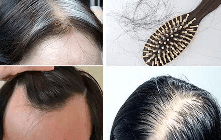 ta|十斤黑芝麻都比上2颗ta！风靡美国的这颗糖把头发越吃越密，皮肤也变好了，感觉年轻10多岁！