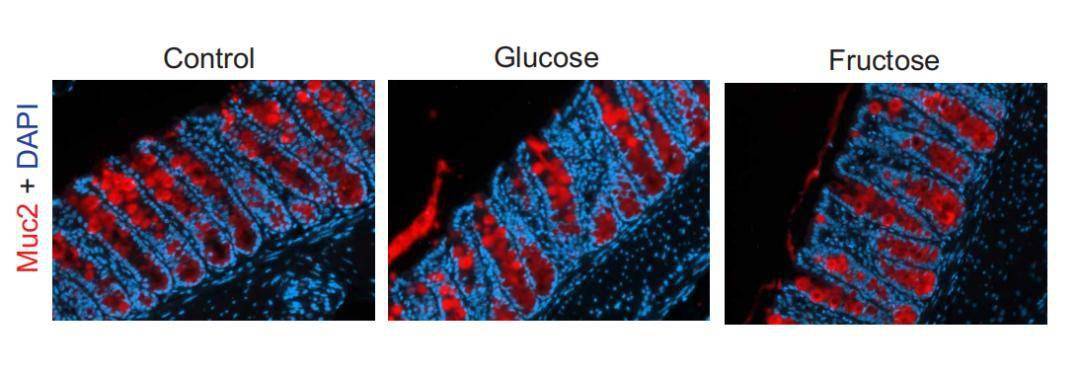 研究|Science子刊：汝之蜜糖，肠胃砒霜！高糖饮食会诱发结肠炎，肠胃不好，竟是因为吃得太甜？