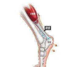 从解剖,分型,诊断到治疗细节,全方位讲解跟腱断裂!