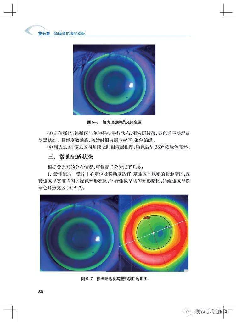 《角膜塑形镜验配实用教程》魏瑞华