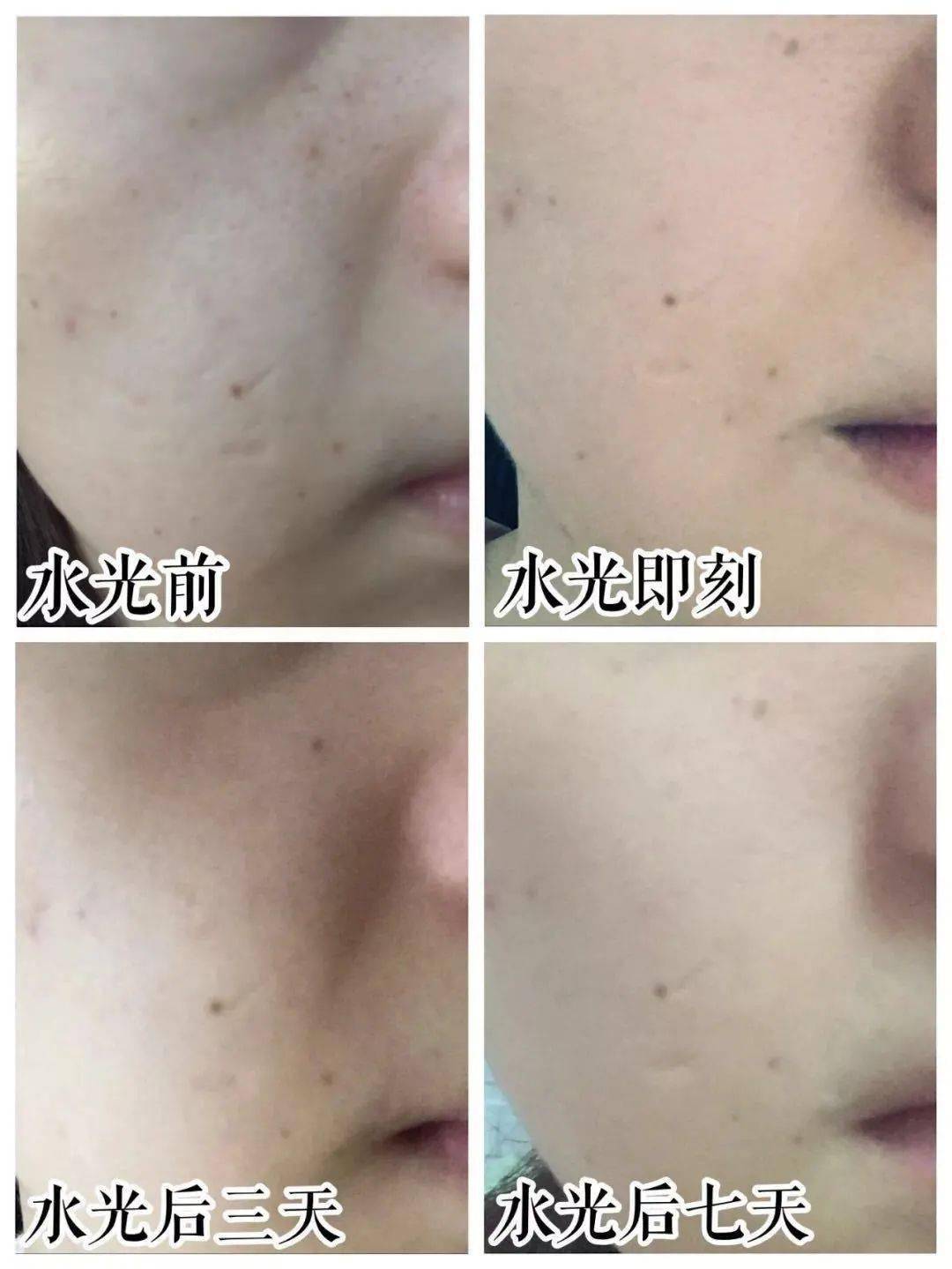 肌肤|嫩到掐出水！用一次比敷100片面膜还白润，10分钟感受女星同款水光肌！