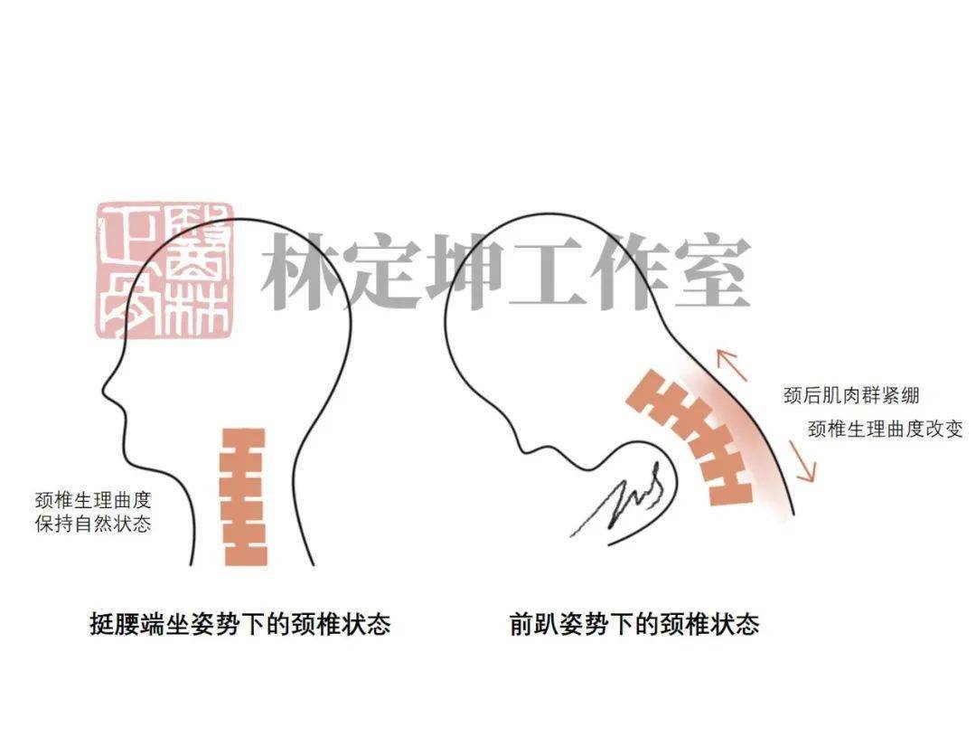 cf9f43b8d1cb40cea95ee325a1616d65.jpeg