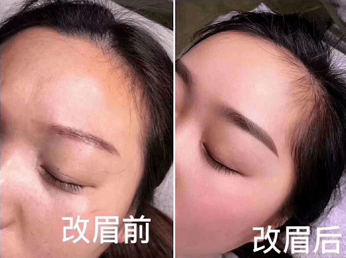 做半永久后眉毛发红发蓝了该怎么办?