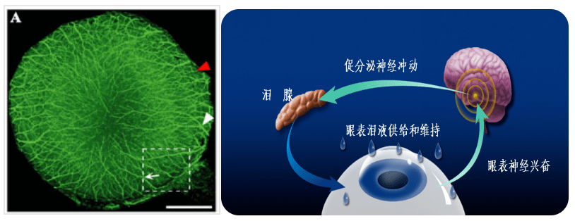 晋秀明教授一文读懂角膜神经痛诊治进展
