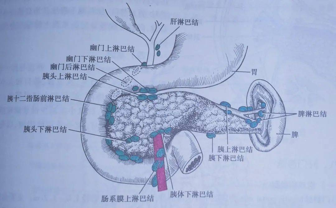 "猛虎"疾病—急性胰腺炎