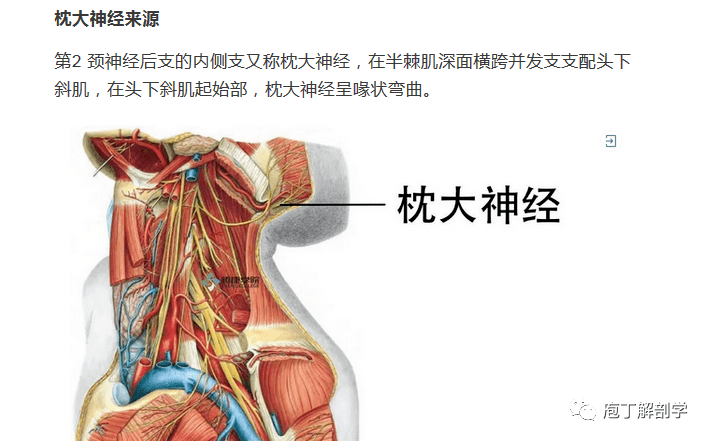 枕大神经卡压