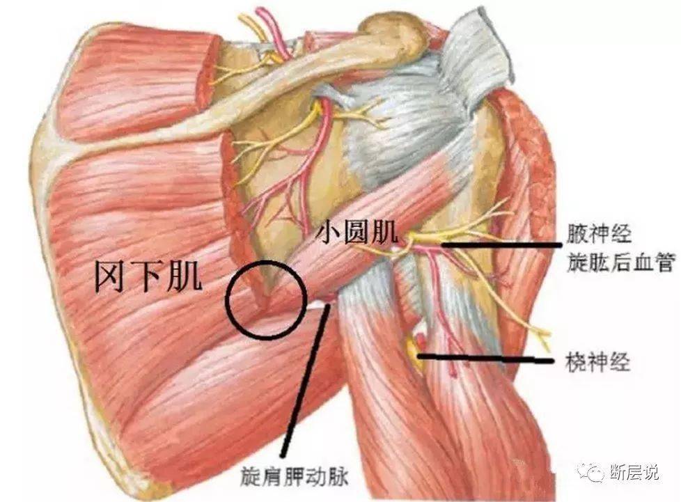 而  小圆肌本身的激痛点