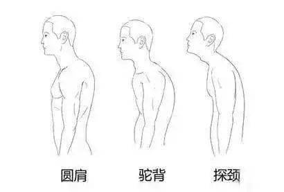 这3种体态问题超毁气质,好多人都中了其中之一