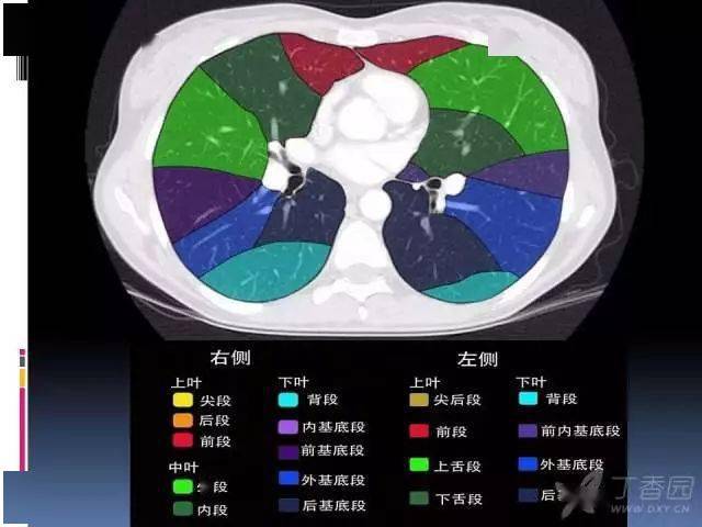 ct入门:肺叶分段,支气管,肺动脉 ct 图谱全在这