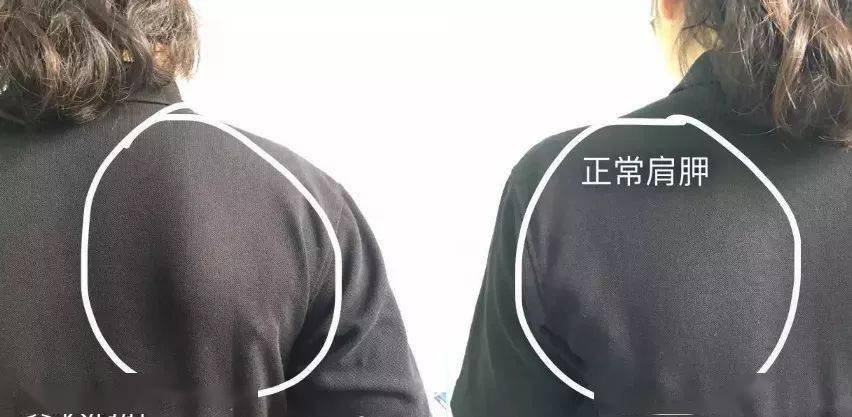 肩胛|迪丽热巴的这张照片,一点都不性感!