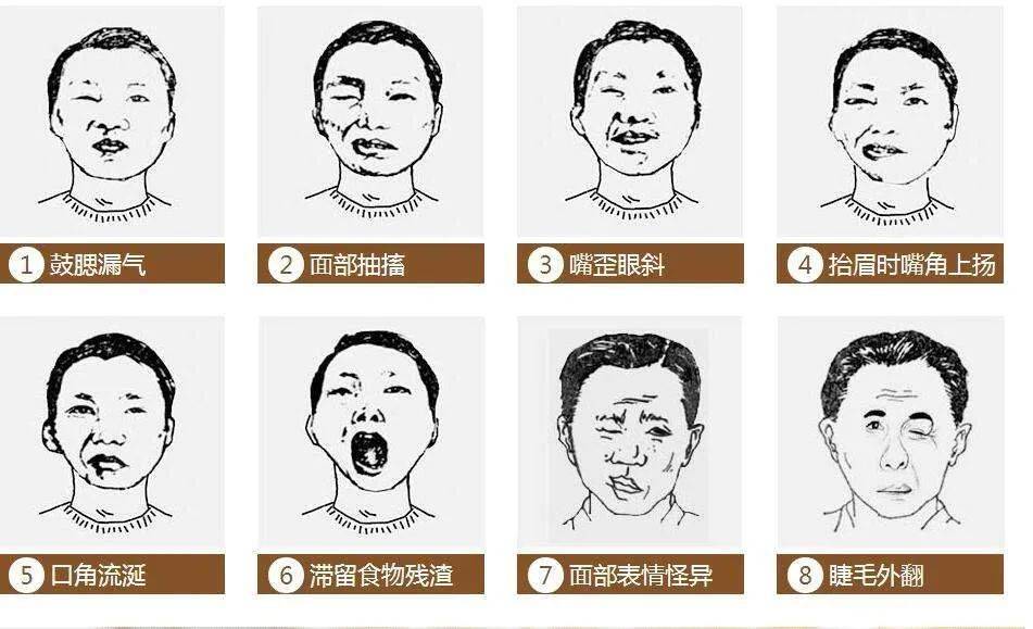 突然"变脸",别再迷信"鬼惊风",专家:及时就诊,别
