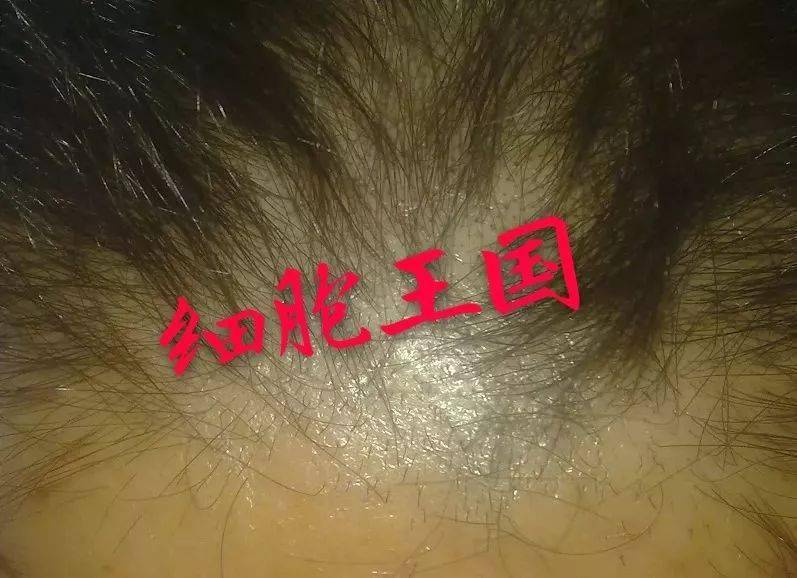 5bf7800a2ca44041869dff0b061b9f28.jpeg