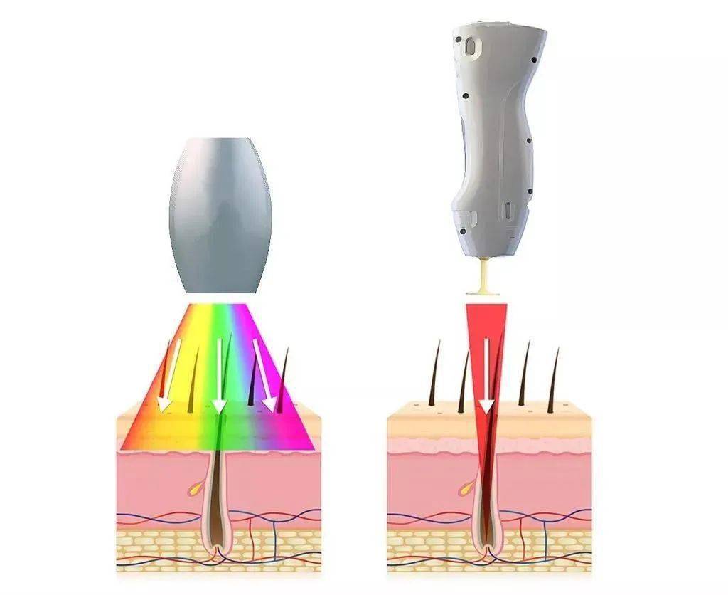 皮肤|一杯奶茶钱就能做的医美，做完立刻后悔！