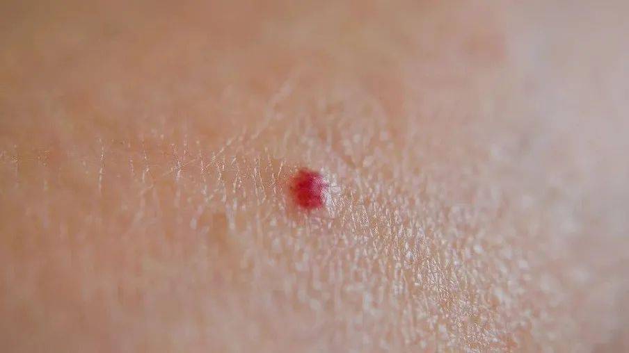 如何快速治好口腔病 012cf43197254df7a8ecac29c3990986.jpeg