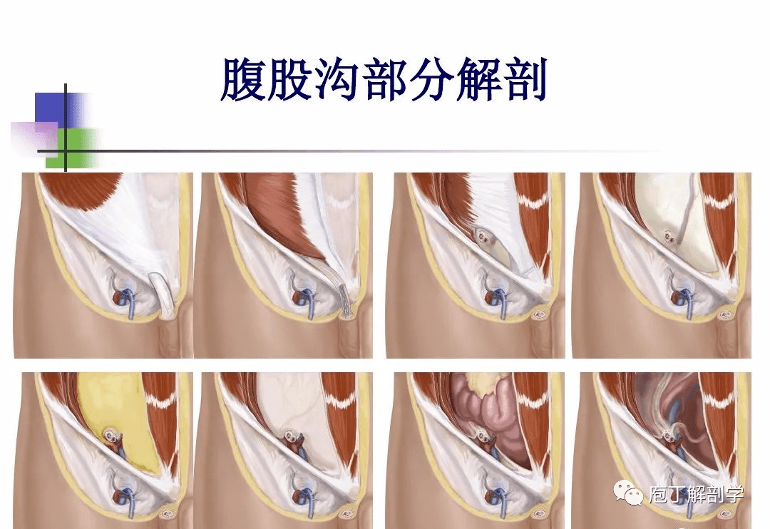 影像解剖 |一图读懂腹股沟区解剖