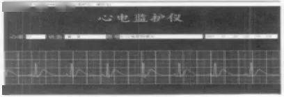 心电监护仪多重要,这些知识你掌握了没?