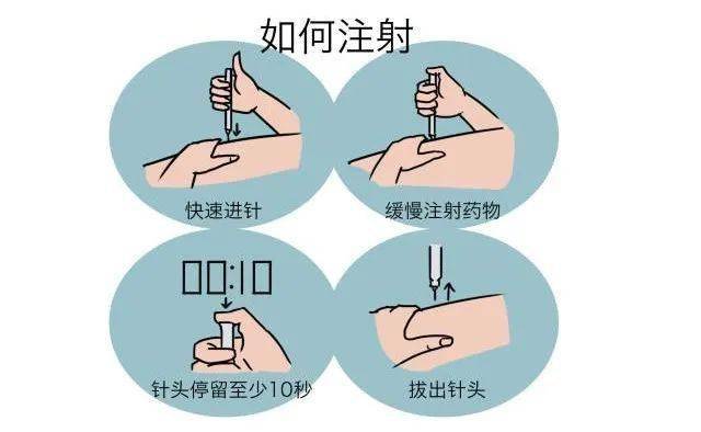 打胰岛素部位图解 9df1257c6b4549519ae83c816e6b1152.jpeg