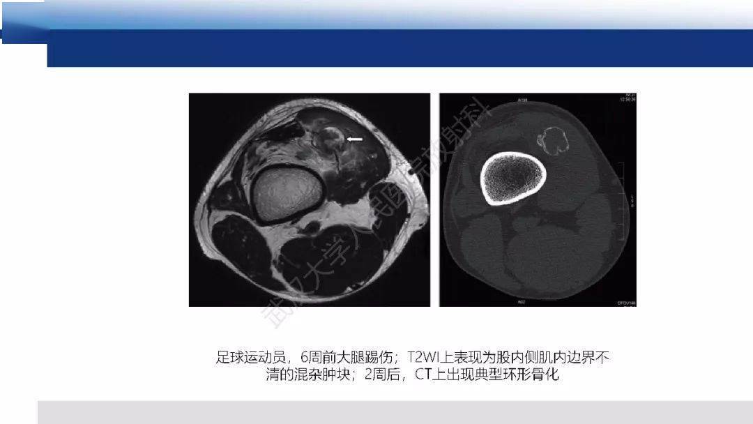 如何判断心脏是生理还是病理的 24d28d2503c24fdaa2b2ebab061fb507.jpeg