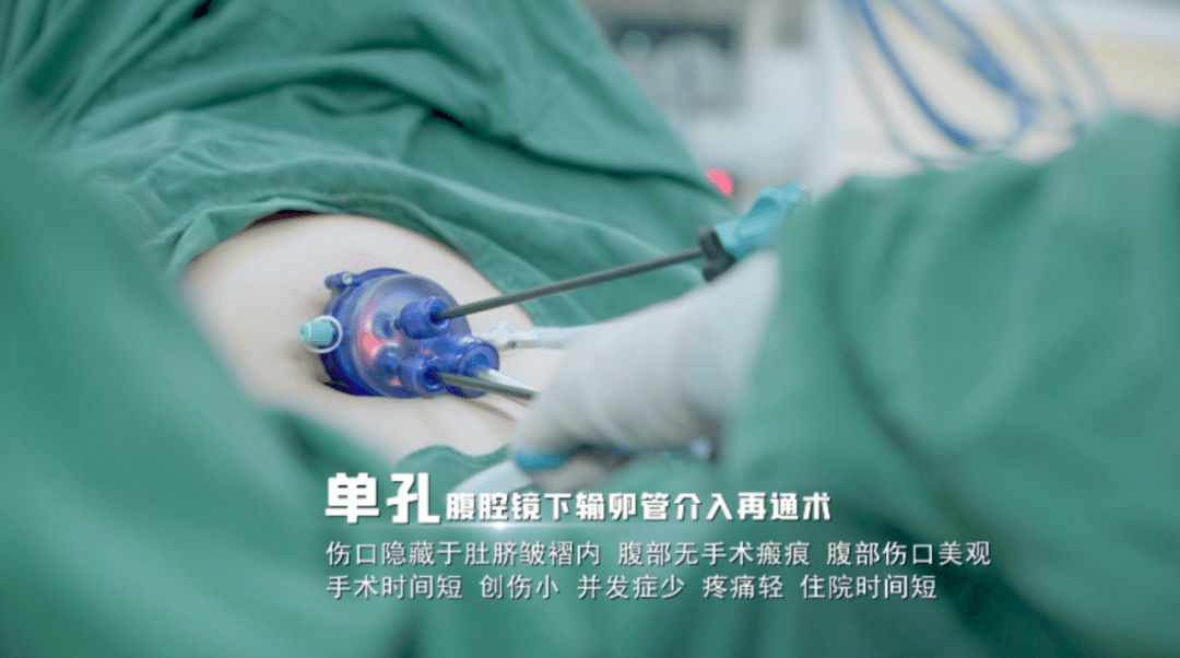 在重庆首批开展 通过手术工具的革新和手术操作的改进 实现子宫输卵管
