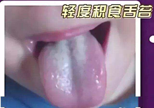 发出的|宝宝发出的积食信号，你看懂了吗？过度喂养导致积食