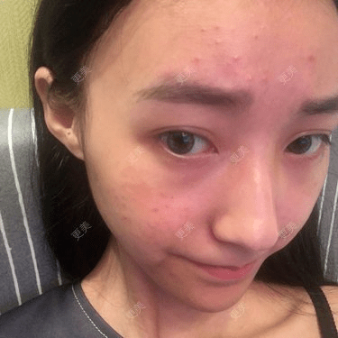 皮肤|杨幂早期合照见心机？看完原图呆了，她们这么早竟都整了...
