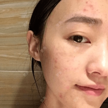 皮肤|杨幂早期合照见心机？看完原图呆了，她们这么早竟都整了...