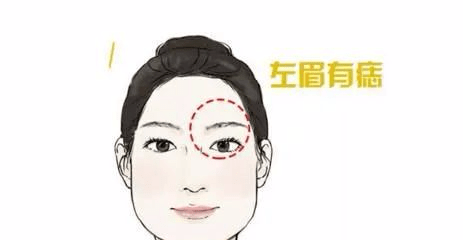 眼睛上方的痣代表什么 3bfedeb916334d0297b4a54398f21ec0.png