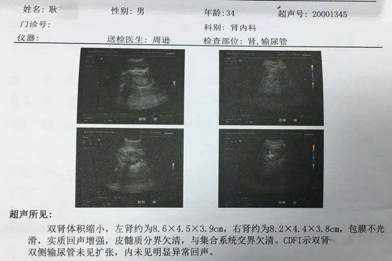 于正常范围血肌酐及内生肌酐清除率等指标明显异常彩超显示双肾明显萎缩