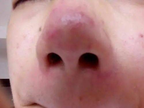 3161bc3934664e6f92e5a178cefabed2.jpeg
