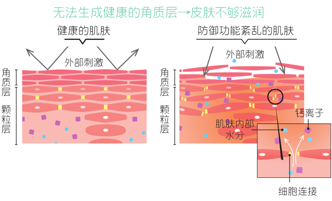 日常工作压力,会导致交感神经兴奋,血管收缩,血液循环变差导致皮肤