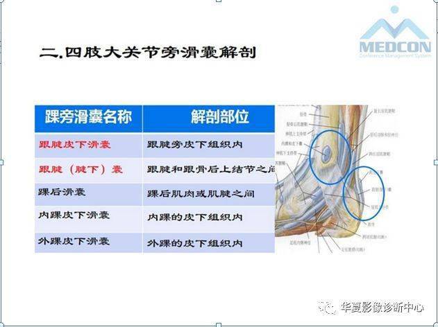 4大关节旁滑囊的精细解剖滑囊病变汇总