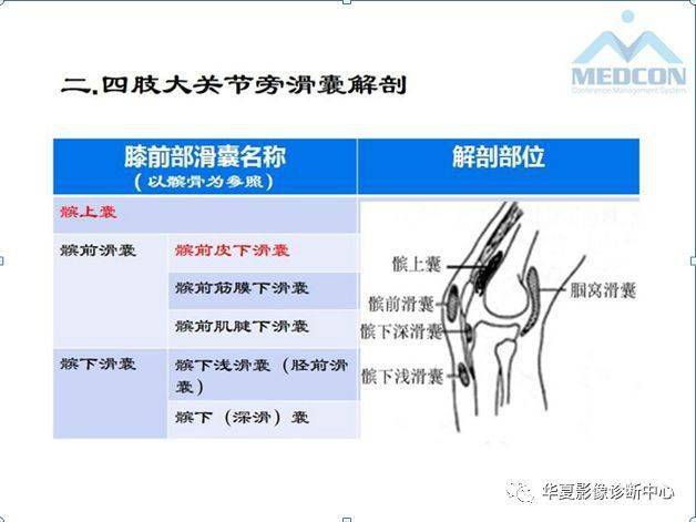 4大关节旁滑囊的精细解剖 滑囊病变汇总