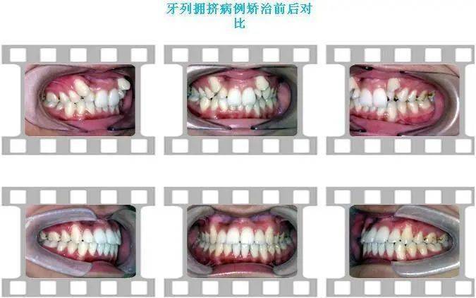 d6ad93535ed7424c89d2e0d2859f0516.jpeg