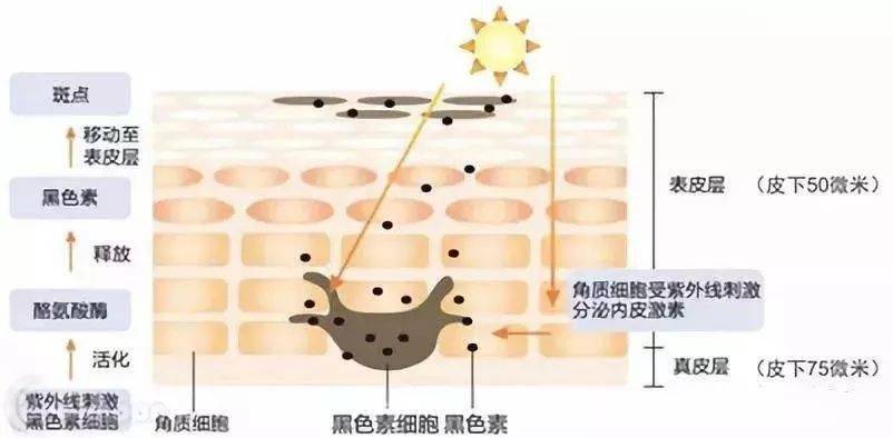 加速黑色素的代谢,避免新的色素沉积.