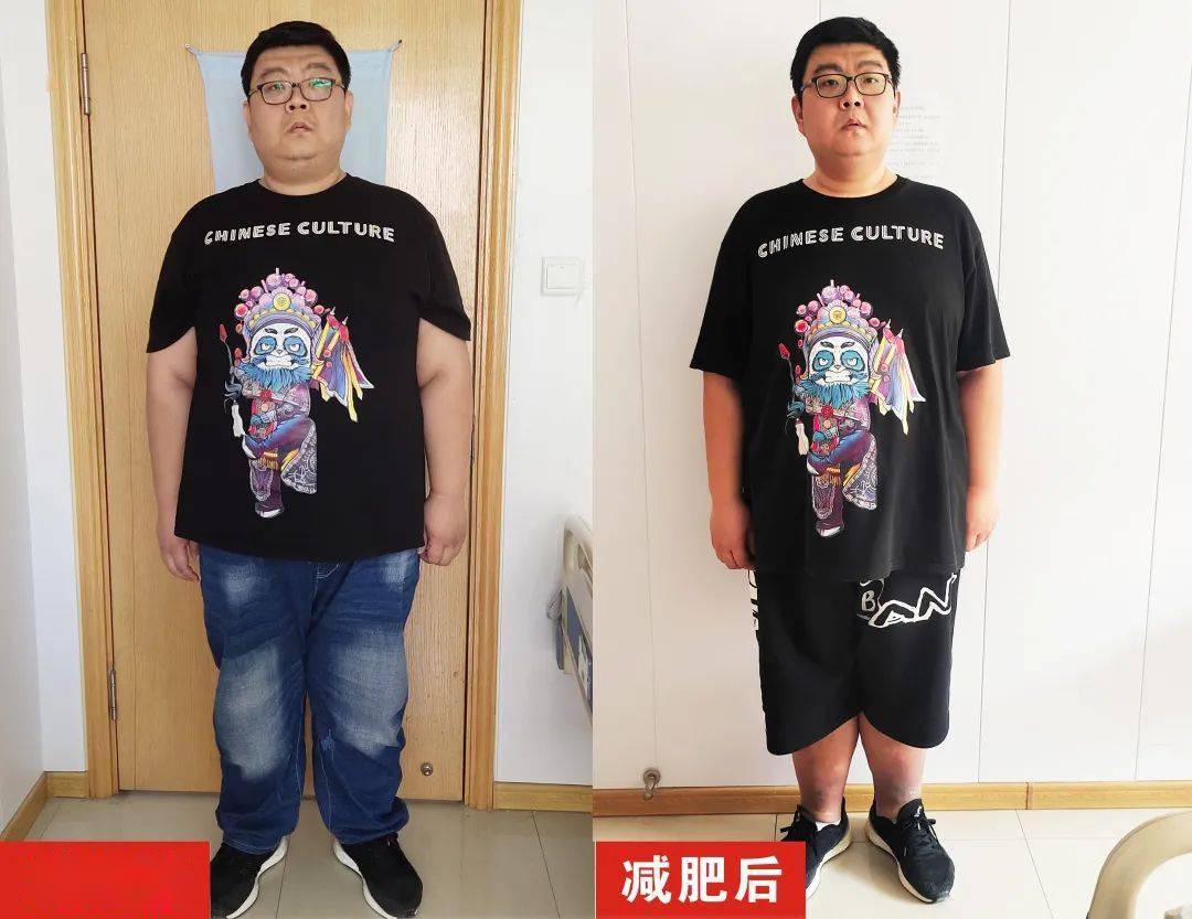 辽宁都市频道新闻正前方跟踪报道封闭减肥45天332斤小伙甩肉70斤