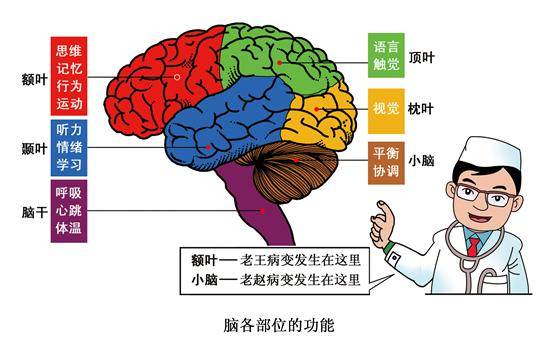 脑卒中发生在大脑各部位会影响人的哪些功能.视觉中国供图