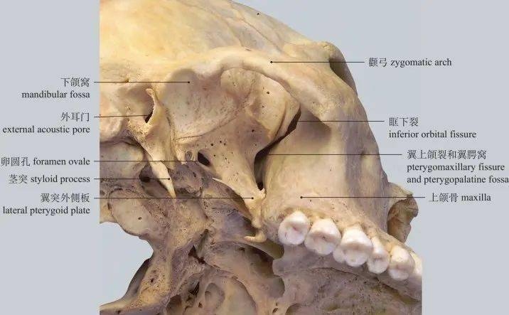 图1-31 颞下窝和翼腭窝infratemporal fossa and pterygopalatine