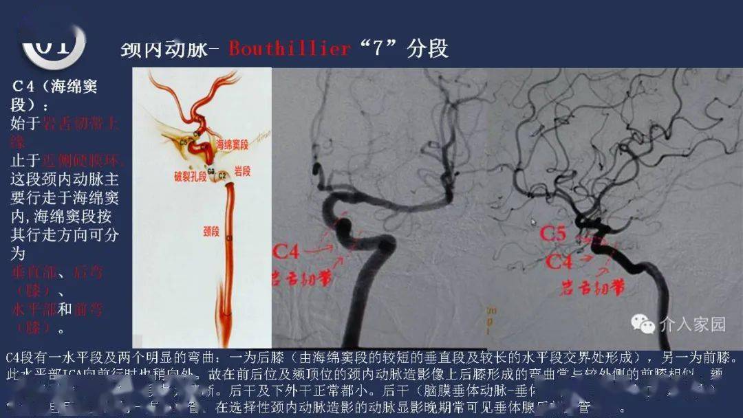 精彩推荐 高清头颈动脉系统解剖