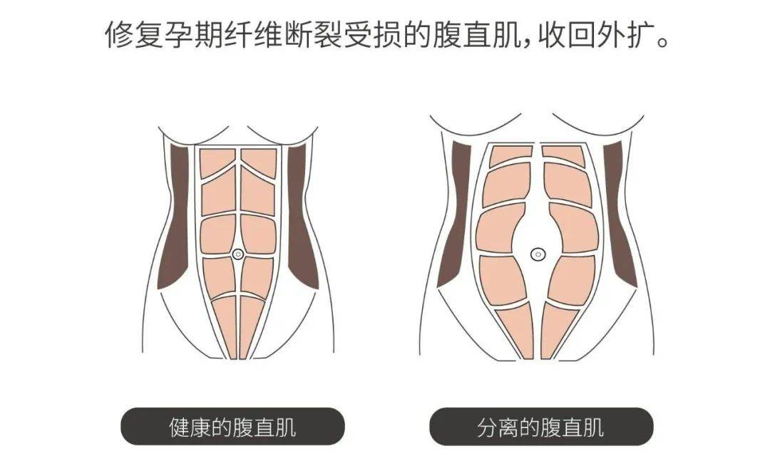 怎么卷腹最有效 0dbb9b973692470fbd7a6f133f856837.jpeg