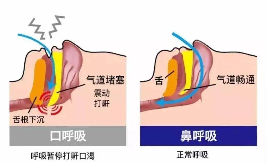 打呼噜也是病,山楂加点它,睡得香,精神好!