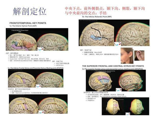 白红民教授:唤醒开颅皮质和皮质下纤维定位
