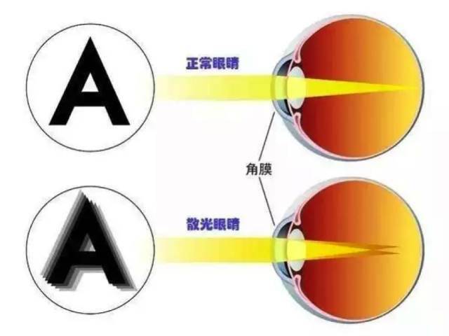 9aceacf65a04492cbbf4915f0c8c9c4a.jpeg