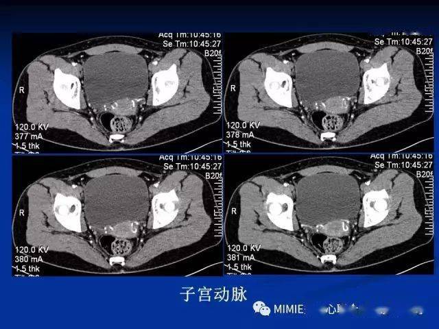 女性生殖系统正常解剖及表现