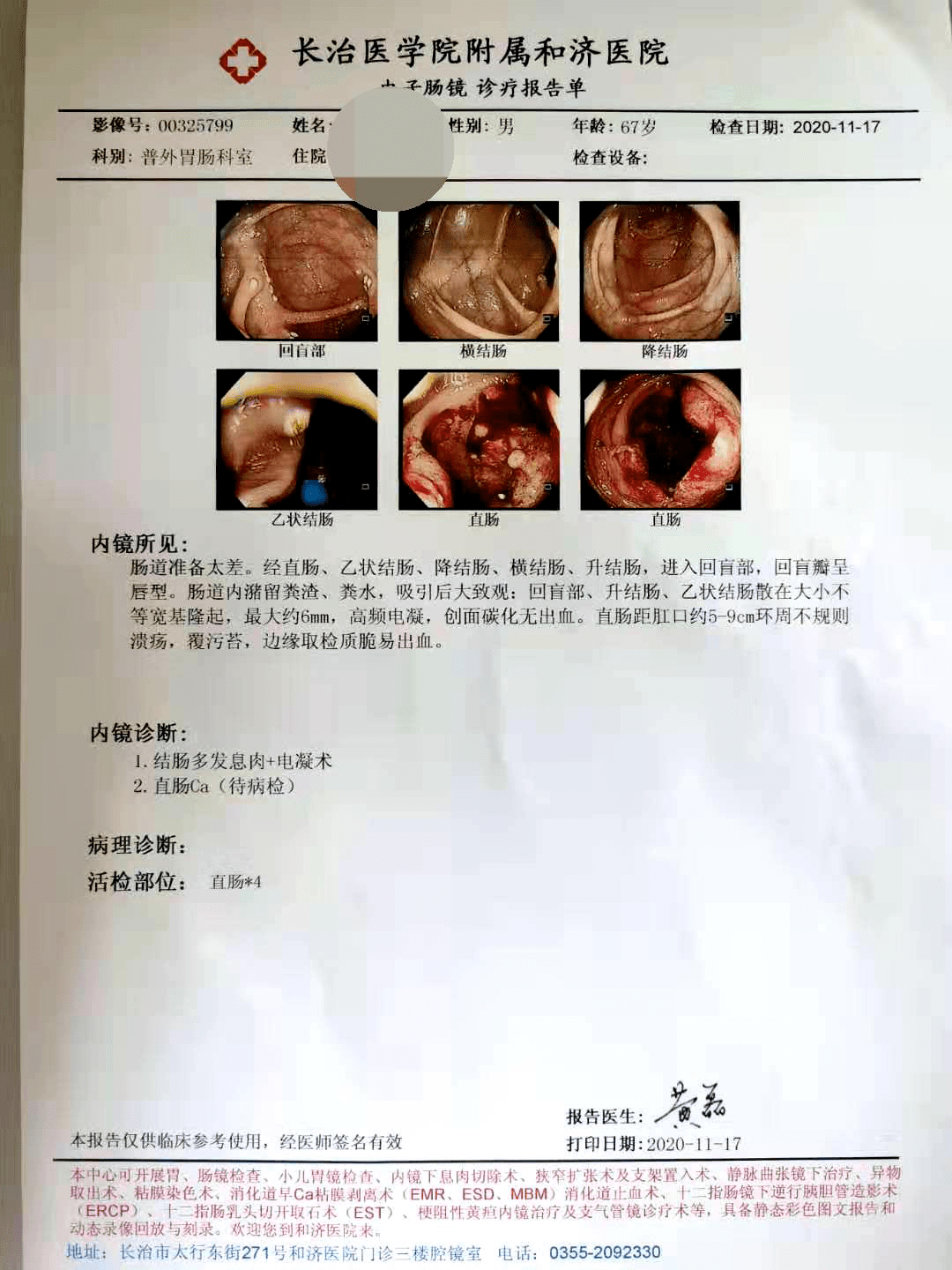 附属和济医院胃肠外科自主开展2例复杂结直肠肿瘤腹腔镜手术治疗_手机
